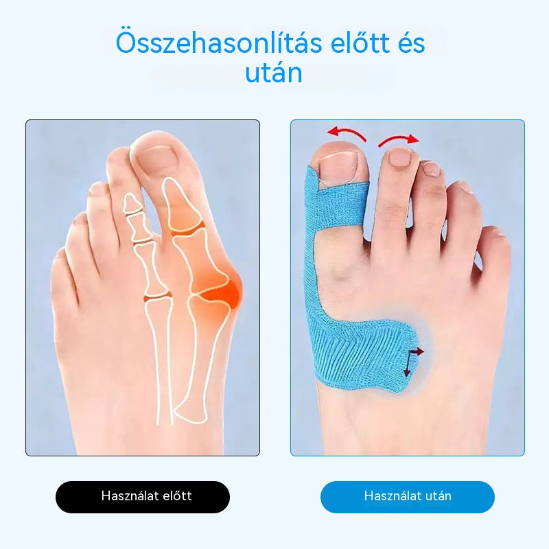 [50 darab] Rugalmas ujjvédők, égési sérülésekre való tapaszok, tartós sportkötések