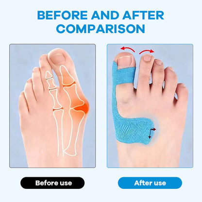 [50 piezas 25€] Protectores de dedos flexibles, parches para quemaduras, vendas deportivas resistentes-4296379